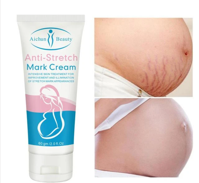 Screenshot_2020-02-26 AICHUN BEAUTY Anti-Stretch Mark Cream Deep Scars Removal Cream(3)