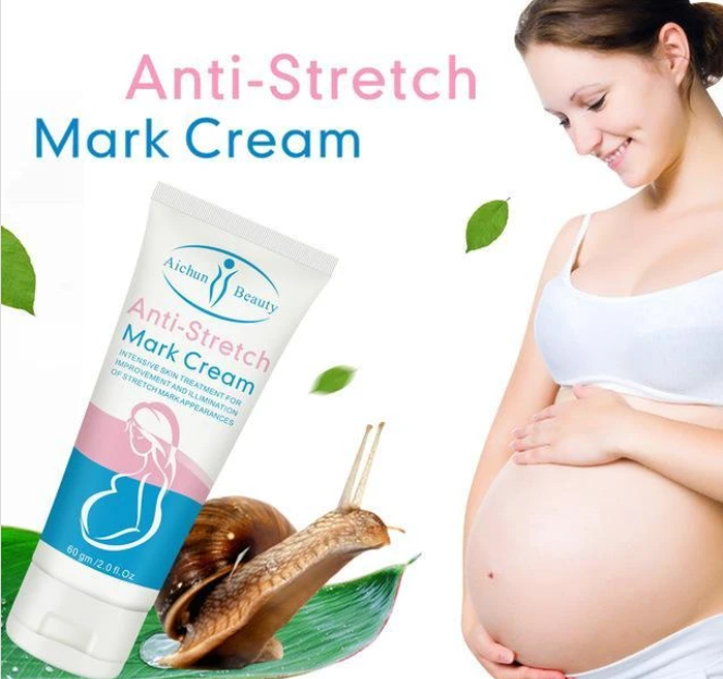 Home screenshot 2024 03 07 at 11 40 06 anti stretch mark cream deep scars removal cream – shop now 247 online store(1)